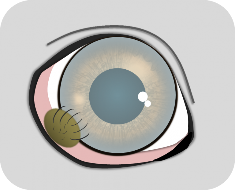 Dermoidentfernung Augentierarzt Allgoewer